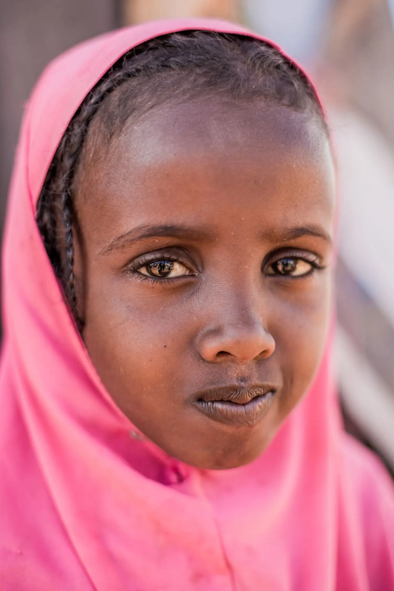 En raison d’une sécheresse importante en Somalie, Marwa, 9 ans, et sa famille souffrent de famine et de malnutrition. 